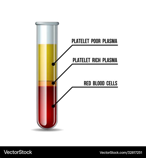 blood centrifuge machine|blood before and after centrifuge.